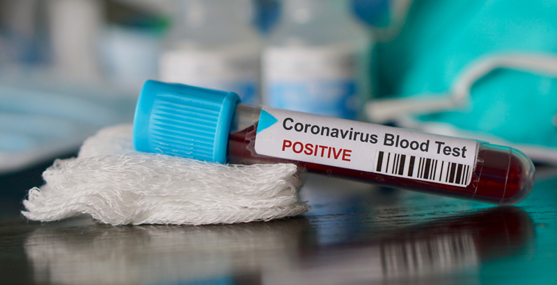 coronavirus latinoamericano