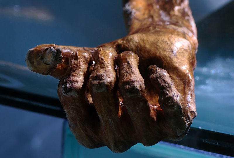 Ötzi muerte